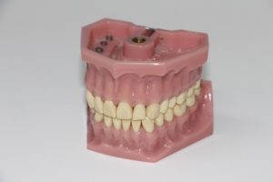 ból zęba