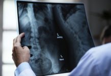 Historia i rozwój dermoskopii