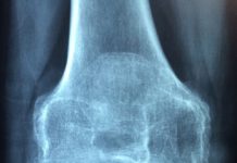 Żelatyna i odchudzanie