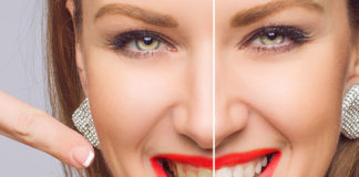 Wybielanie zębów magic white – czy warto się skusić?